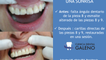 Carilla Dental